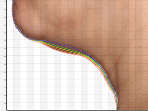 CMA02 neck analysis