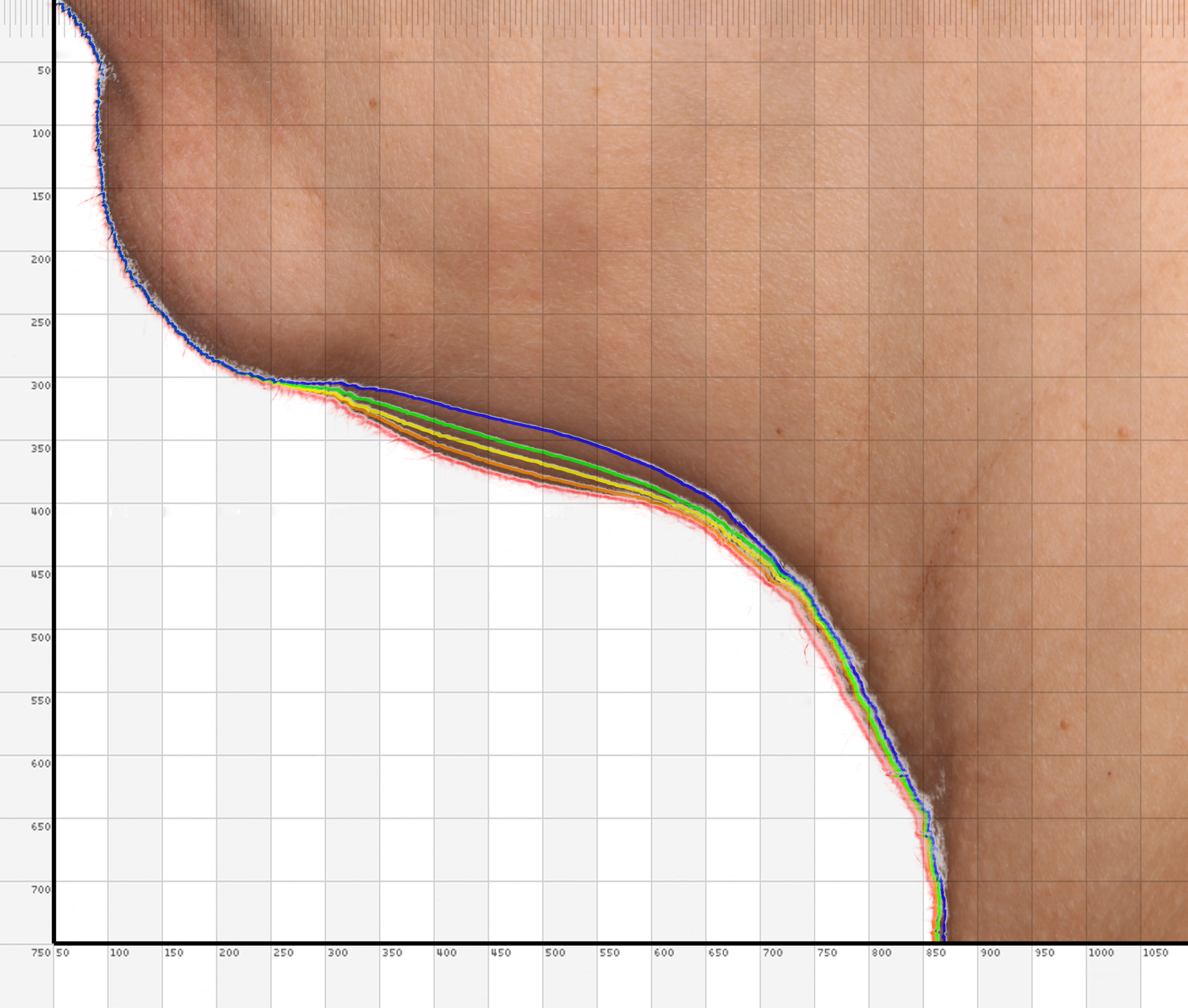 CMA02 neck analysis