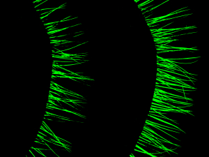 Photogrammetrix eyelash density Right Eye PhGx