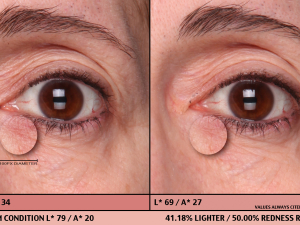 UND08 64-5026 Baseline, 10 Min Right Eye Color PhGx